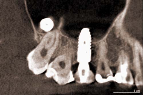 DVT – Digital Volume Tomography