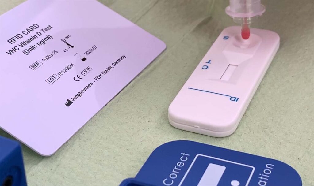 Medizinischer Vitamin D Test