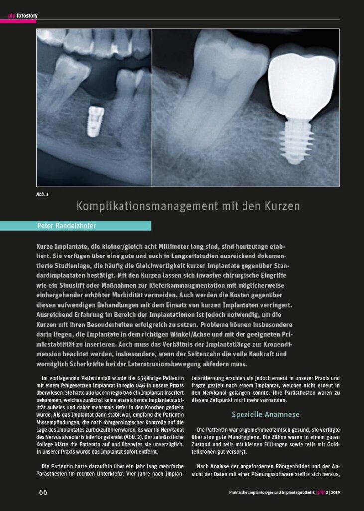 PIP Fotostory 2/2019: Komplikationsmanagement mit den Kurzen Implantaten