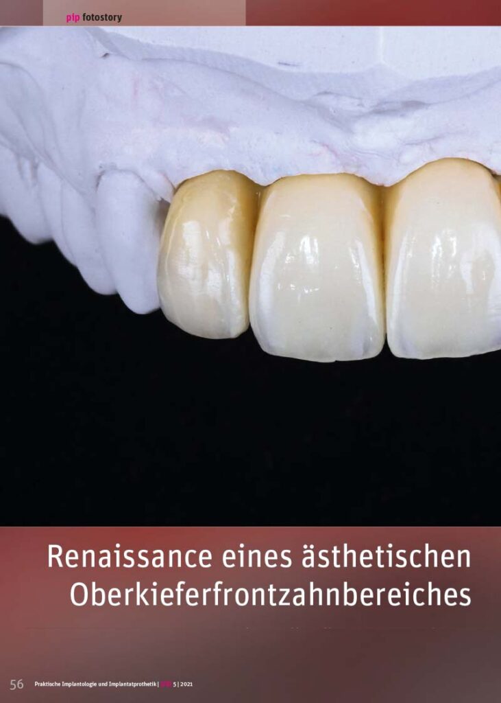 PIP Fotostory 5/2021: Renaissance eines ästhetischen Oberkieferfrontzahnbereiches