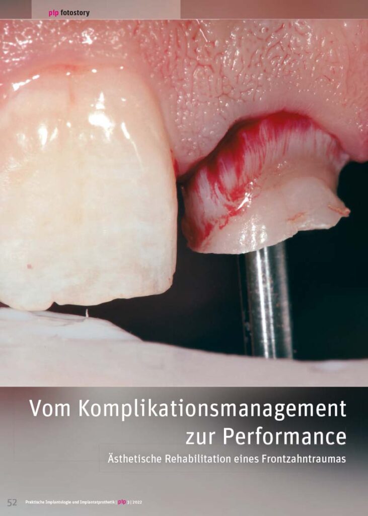 PIP Fotostory 3/2022: Vom Komplikationsmanagement zur Performance